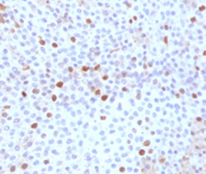 TOP2A / Topoisomerase II Alpha Antibody -  This image was taken for the unmodified form of this product. Other forms have not been tested.