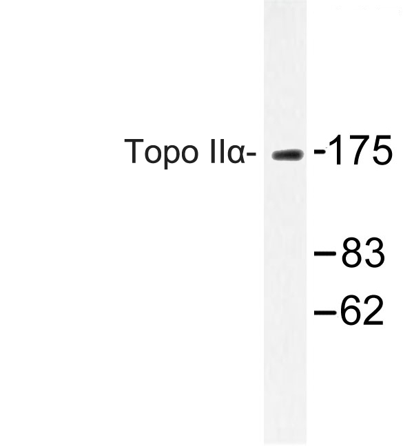 TOP2A / Topoisomerase II Alpha Antibody - Western blot of Topo II (Q14) pAb in extracts from HT-29.