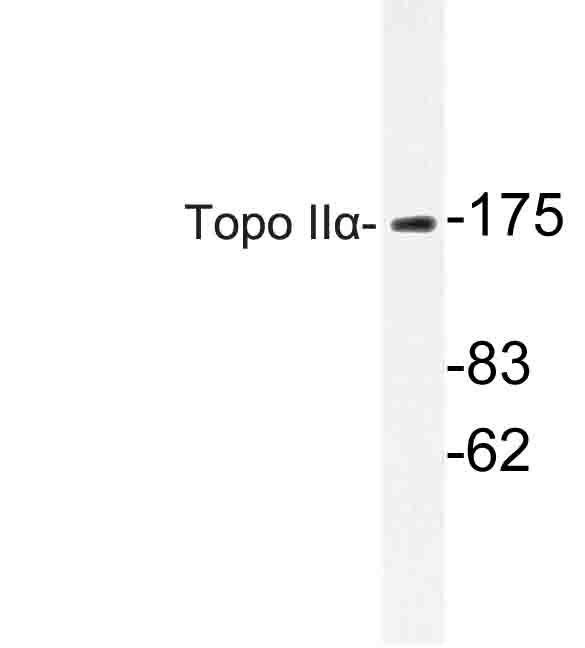 TOP2A / Topoisomerase II Alpha Antibody - Western blot of Topo II (E1102) pAb in extracts from LOVO cells.