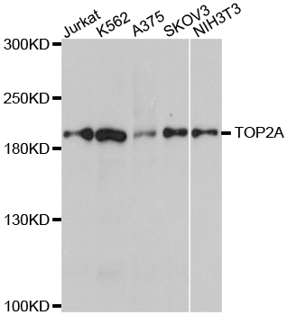 TOP2A / Topoisomerase II Alpha Antibody - Western blot analysis of extracts of various cell lines, using TOP2A antibody at 1:1000 dilution. The secondary antibody used was an HRP Goat Anti-Rabbit IgG (H+L) at 1:10000 dilution. Lysates were loaded 25ug per lane and 3% nonfat dry milk in TBST was used for blocking. An ECL Kit was used for detection and the exposure time was 30s.