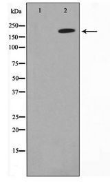 TOP2A / Topoisomerase II Alpha Antibody - Western blot of Jurkat cell lysate using TOP2A Antibody