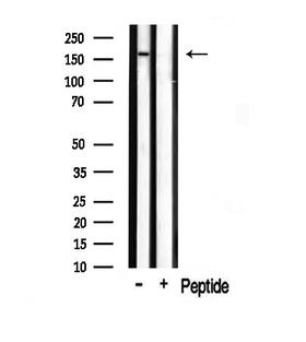 TOP2A / Topoisomerase II Alpha Antibody - Western blot analysis on mouse muscle lysate using TOP2A antibody