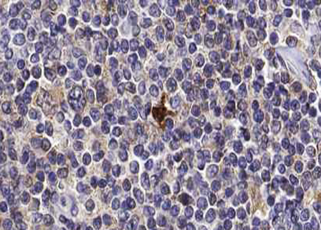TOP2A / Topoisomerase II Alpha Antibody - 1:100 staining human lymph node tissue by IHC-P. The tissue was formaldehyde fixed and a heat mediated antigen retrieval step in citrate buffer was performed. The tissue was then blocked and incubated with the antibody for 1.5 hours at 22°C. An HRP conjugated goat anti-rabbit antibody was used as the secondary.