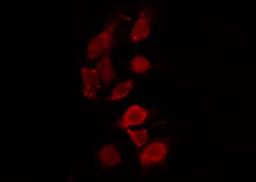 TOP2A / Topoisomerase II Alpha Antibody - Staining HeLa cells by IF/ICC. The samples were fixed with PFA and permeabilized in 0.1% Triton X-100, then blocked in 10% serum for 45 min at 25°C. The primary antibody was diluted at 1:200 and incubated with the sample for 1 hour at 37°C. An Alexa Fluor 594 conjugated goat anti-rabbit IgG (H+L) Ab, diluted at 1/600, was used as the secondary antibody.