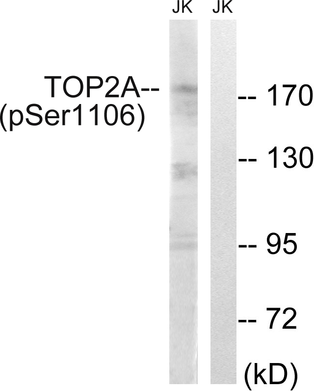 TOP2A / Topoisomerase II Alpha Antibody - Western blot analysis of lysates from Jurkat cells treated with paclitaxel 1uM 24h, using TOP2A (Phospho-Ser1106) Antibody. The lane on the right is blocked with the phospho peptide.