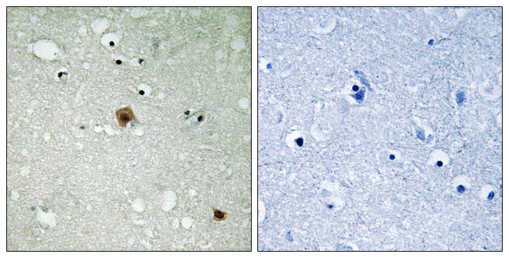 TOP2A / Topoisomerase II Alpha Antibody - Immunohistochemistry analysis of paraffin-embedded human brain, using TOP2A (Phospho-Ser1525) Antibody. The picture on the right is blocked with the phospho peptide.