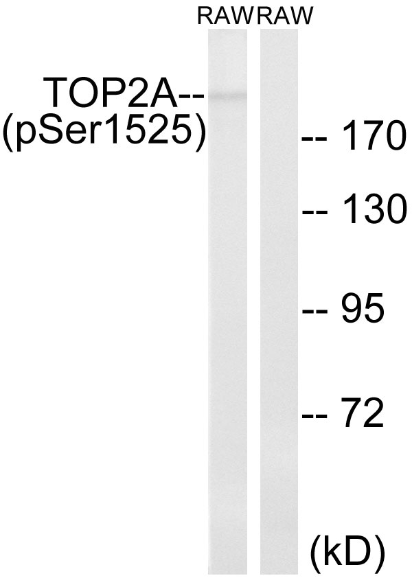 TOP2A / Topoisomerase II Alpha Antibody - Western blot analysis of lysates from RAW264.7 cells treated with TNF 20ng/ml 5', using TOP2A (Phospho-Ser1525) Antibody. The lane on the right is blocked with the phospho peptide.