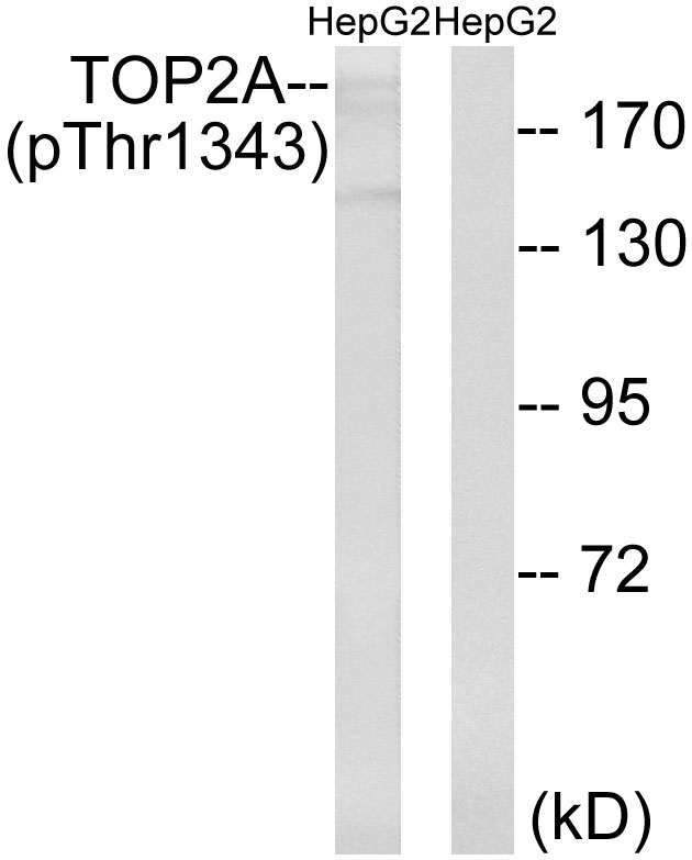 TOP2A / Topoisomerase II Alpha Antibody - Western blot analysis of lysates from HepG2 cells treated with Ca2+ 40nM 30', using TOP2A (Phospho-Thr1343) Antibody. The lane on the right is blocked with the phospho peptide.
