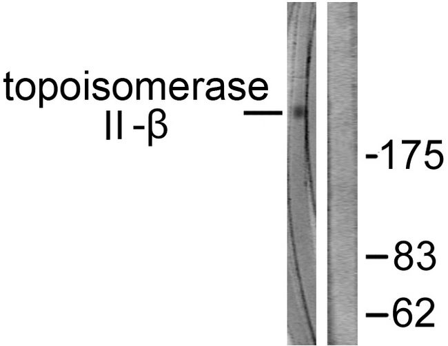 TOP2B / Topoisomerase II Beta Antibody - Western blot analysis of lysates from Jurkat cells, using TOP2B Antibody. The lane on the right is blocked with the synthesized peptide.