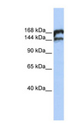 TOP2B / Topoisomerase II Beta Antibody - TOP2B antibody Western blot of Jurkat lysate. This image was taken for the unconjugated form of this product. Other forms have not been tested.