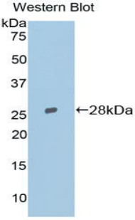 TOP2B / Topoisomerase II Beta Antibody - Western blot of recombinant TOP2B / Topoisomerase II Beta.  This image was taken for the unconjugated form of this product. Other forms have not been tested.