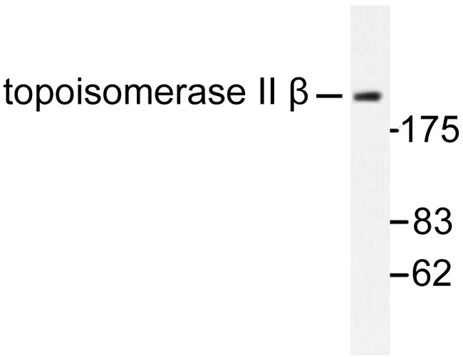 TOP2B / Topoisomerase II Beta Antibody - Western blot of Topoisomerase II (A32) pAb in extracts from Jurkat cells.