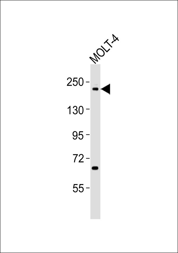 TOP2B / Topoisomerase II Beta Antibody - Anti-Topoisomerase 2 beta Antibody at 1:1000 dilution + MOLT-4 whole cell lysates Lysates/proteins at 20 ug per lane. Secondary Goat Anti-Rabbit IgG, (H+L),Peroxidase conjugated at 1/10000 dilution Predicted band size : 183 kDa Blocking/Dilution buffer: 5% NFDM/TBST.