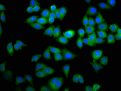 TOP2B / Topoisomerase II Beta Antibody - Immunofluorescence staining of Hela cells with TOP2B Antibody at 1:100, counter-stained with DAPI. The cells were fixed in 4% formaldehyde, permeabilized using 0.2% Triton X-100 and blocked in 10% normal Goat Serum. The cells were then incubated with the antibody overnight at 4°C. The secondary antibody was Alexa Fluor 488-congugated AffiniPure Goat Anti-Rabbit IgG(H+L).
