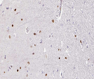 TOP2B / Topoisomerase II Beta Antibody - 1:100 staining human brain tissue by IHC-P. The tissue was formaldehyde fixed and a heat mediated antigen retrieval step in citrate buffer was performed. The tissue was then blocked and incubated with the antibody for 1.5 hours at 22°C. An HRP conjugated goat anti-rabbit antibody was used as the secondary.