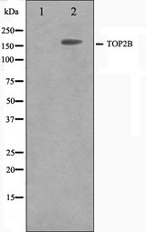 TOP2B / Topoisomerase II Beta Antibody - Western blot analysis on Jurkat cell lysates using TOP2B antibody. The lane on the left is treated with the antigen-specific peptide.