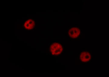 TOP2B / Topoisomerase II Beta Antibody - Staining HeLa cells by IF/ICC. The samples were fixed with PFA and permeabilized in 0.1% Triton X-100, then blocked in 10% serum for 45 min at 25°C. The primary antibody was diluted at 1:200 and incubated with the sample for 1 hour at 37°C. An Alexa Fluor 594 conjugated goat anti-rabbit IgG (H+L) Ab, diluted at 1/600, was used as the secondary antibody.