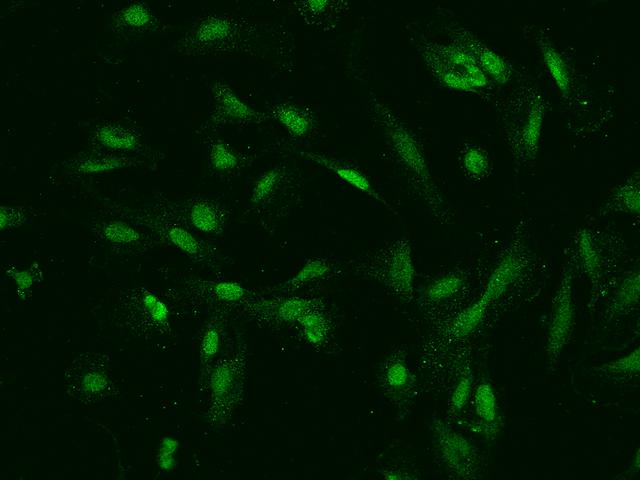 TOP2B / Topoisomerase II Beta Antibody - Immunofluorescence staining of TOP2B in U251MG cells. Cells were fixed with 4% PFA, permeabilzed with 0.1% Triton X-100 in PBS, blocked with 10% serum, and incubated with rabbit anti-Human TOP2B polyclonal antibody (dilution ratio 1:200) at 4°C overnight. Then cells were stained with the Alexa Fluor 488-conjugated Goat Anti-rabbit IgG secondary antibody (green). Positive staining was localized to Nucleus and cytoplasm.