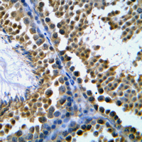 TOP2B / Topoisomerase II Beta Antibody - Immunohistochemical analysis of Topoisomerase 2 beta staining in human tonsil formalin fixed paraffin embedded tissue section. The section was pre-treated using heat mediated antigen retrieval with sodium citrate buffer (pH 6.0). The section was then incubated with the antibody at room temperature and detected using an HRP conjugated compact polymer system. DAB was used as the chromogen. The section was then counterstained with hematoxylin and mounted with DPX.
