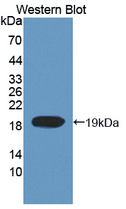 TOP3A Antibody - Western blot of TOP3A antibody.