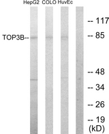 TOP3B Antibody - Western blot analysis of lysates from HepG2, COLO205, and HUVEC cells, using TOP3B Antibody. The lane on the right is blocked with the synthesized peptide.
