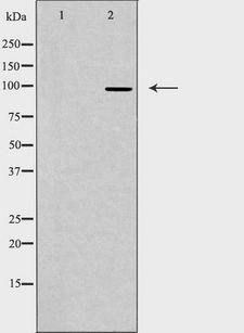 TOP3B Antibody - Western blot analysis of extracts of HepG2 cells using TOP3B antibody