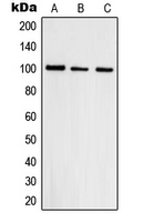 TOP3B Antibody - Western blot analysis of Topoisomerase 3 beta1 expression in HepG2 (A); A431 (B); HeLa (C) whole cell lysates.