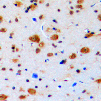 TOP3B Antibody - Immunohistochemical analysis of Topoisomerase 3 beta1 staining in human brain formalin fixed paraffin embedded tissue section. The section was pre-treated using heat mediated antigen retrieval with sodium citrate buffer (pH 6.0). The section was then incubated with the antibody at room temperature and detected using an HRP conjugated compact polymer system. DAB was used as the chromogen. The section was then counterstained with hematoxylin and mounted with DPX.