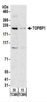 TOPBP1 Antibody - Detection of Mouse T op BP1 by Western Blot. Samples: Whole cell lysate from TCMK-1 (15 and 50 ug) cells. Antibodies: Affinity purified rabbit anti-TopBP1 antibody used for WB at 1 ug/ml. Detection: Chemiluminescence with an exposure time of 3 minutes.