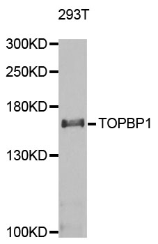 TOPBP1 Antibody - Western blot analysis of extracts of 293T cells.
