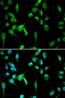 TOPBP1 Antibody - Immunofluorescence analysis of A549 cells.