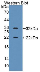 TOPBP1 Antibody