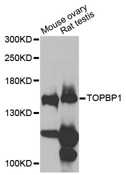 TOPBP1 Antibody - Western blot analysis of extracts of various cell lines, using TOPBP1 antibody at 1:1000 dilution. The secondary antibody used was an HRP Goat Anti-Rabbit IgG (H+L) at 1:10000 dilution. Lysates were loaded 25ug per lane and 3% nonfat dry milk in TBST was used for blocking.