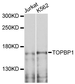 TOPBP1 Antibody - Western blot analysis of extracts of various cell lines, using TOPBP1 antibody at 1:1000 dilution. The secondary antibody used was an HRP Goat Anti-Rabbit IgG (H+L) at 1:10000 dilution. Lysates were loaded 25ug per lane and 3% nonfat dry milk in TBST was used for blocking. An ECL Kit was used for detection and the exposure time was 30s.