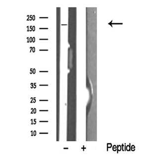 TOPBP1 Antibody - Western blot analysis of TOPBP1 in lysates of HeLa cells using TOPBP1 antibody.