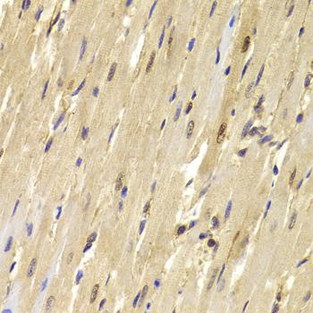 TOPBP1 Antibody - Immunohistochemistry of paraffin-embedded Mouse heart using TOPBP1 Polyclonal Antibody at dilution of 1:100 (40x lens).