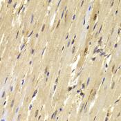 TOPBP1 Antibody - Immunohistochemistry of paraffin-embedded Mouse heart using TOPBP1 Polyclonal Antibody at dilution of 1:100 (40x lens).