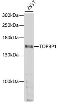 TOPBP1 Antibody - Western blot analysis of extracts of 293T cells using TOPBP1 Polyclonal Antibody at dilution of 1:1000.