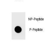 TOPBP1 Antibody - Dot blot of Phospho-TOPBP1-S1159 Antibody Phospho-specific antibody on nitrocellulose membrane. 50ng of Phospho-peptide or Non Phospho-peptide per dot were adsorbed. Antibody working concentrations are 0.6ug per ml.