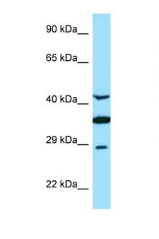 TOR1A / Torsin A Antibody - TOR1A / Torsin A antibody Western blot of Fetal Brain lysate. Antibody concentration 1 ug/ml.  This image was taken for the unconjugated form of this product. Other forms have not been tested.