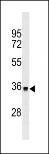 TOR1A / Torsin A Antibody - DYT1 Antibody western blot of ZR-75-1 cell line lysates (35 ug/lane). The DYT1 antibody detected the DYT1 protein (arrow).
