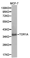TOR1A / Torsin A Antibody - Western blot of extracts of MCF-7 cell lines, using TOR1A antibody.