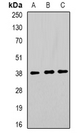 TOR1A / Torsin A Antibody - Western blot analysis of TorsinA expression in MCF7 (A); SW480 (B); mouse liver (C) whole cell lysates.