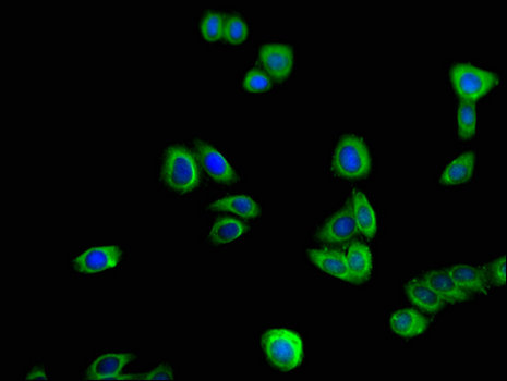 TOR1A / Torsin A Antibody - Immunofluorescent analysis of HepG2 cells using TOR1A Antibody at a dilution of 1:100 and Alexa Fluor 488-congugated AffiniPure Goat Anti-Rabbit IgG(H+L)