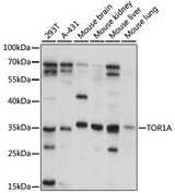 TOR1A / Torsin A Antibody - Western blot analysis of extracts of various cell lines, using TOR1A antibody at 1:1000 dilution. The secondary antibody used was an HRP Goat Anti-Rabbit IgG (H+L) at 1:10000 dilution. Lysates were loaded 25ug per lane and 3% nonfat dry milk in TBST was used for blocking. An ECL Kit was used for detection and the exposure time was 15s.