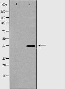 TOR1A / Torsin A Antibody - Western blot analysis of extracts of MCF-7 using TOR1A antibody. The lane on the left is treated with the antigen-specific peptide.
