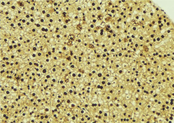 TOR1A / Torsin A Antibody - 1:100 staining mouse liver tissue by IHC-P. The sample was formaldehyde fixed and a heat mediated antigen retrieval step in citrate buffer was performed. The sample was then blocked and incubated with the antibody for 1.5 hours at 22°C. An HRP conjugated goat anti-rabbit antibody was used as the secondary.