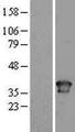 TOR1A / Torsin A Protein - Western validation with an anti-DDK antibody * L: Control HEK293 lysate R: Over-expression lysate