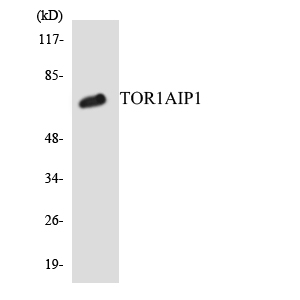 TOR1AIP1 / LAP1 Antibody - Western blot analysis of the lysates from COLO205 cells using TOR1AIP1 antibody.