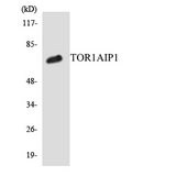 TOR1AIP1 / LAP1 Antibody - Western blot analysis of the lysates from COLO205 cells using TOR1AIP1 antibody.